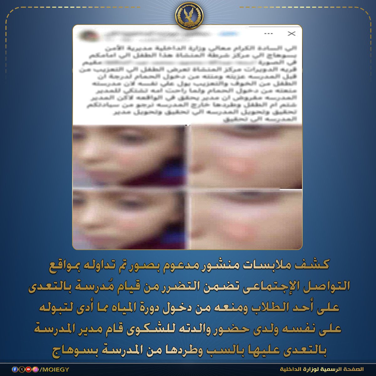 moiegy's tweet photo. فى إطار كشف ملابسات منشور مدعوم بصور تم تداوله بمواقع التواصل الإجتماعى تضمن التضرر من قيام مُدرسة بالتعدى على أحد الطلاب ومنعه من دخول دورة المياه مما أدى لتبوله على نفسه ولدى حضور والدته للشكوى قام مدير المدرسة بالتعدى عليها بالسب وطردها من المدرسة بسوهاج.

بالفحص تبين عدم ورود ثمة بلاغات فى هذا الشأن ، أمكن تحديد والدى الطفل المشار إليه (عامل ، ربة منزل – مقيمان بدائرة مركز شرطة المنشأة بسوهاج ) ، وبسؤالهما قررا بتضررهما من (معلمة بمدرسة كائنة بدائرة المركز ، مدير المدرسة ) لقيام المعُلمة  بالتعدى على نجليهما (طالب " سن 7") وحرقه بوجهه ولدى قيام والدة الطفل بالتوجه للشكوى قام مدير المدرسة بالتعدى عليها بالسب وطردها من المدرسة. 

أمكن تحديد المعلمة المشكو فى حقها (مقيمه بدائرة المركز) ، وبمواجهتها أقرت بإرتكابها الواقعة على النحو المشار إليه بتاريخ 17/ الجارى بإستخدام قداحة بقصد تهذيب الطالب وتخلصت منها عقب الواقعة ، وأنكرت منعه من دخول دورة المياه، وبسؤال مدير المدرسة أفاد بقيام والدة الطالب بالصياح فـى وجهه دون توضيح ما حدث وعدم علمه بتفصيلات الواقعة. 

تم إتخاذ الإجراءات القانونية.
