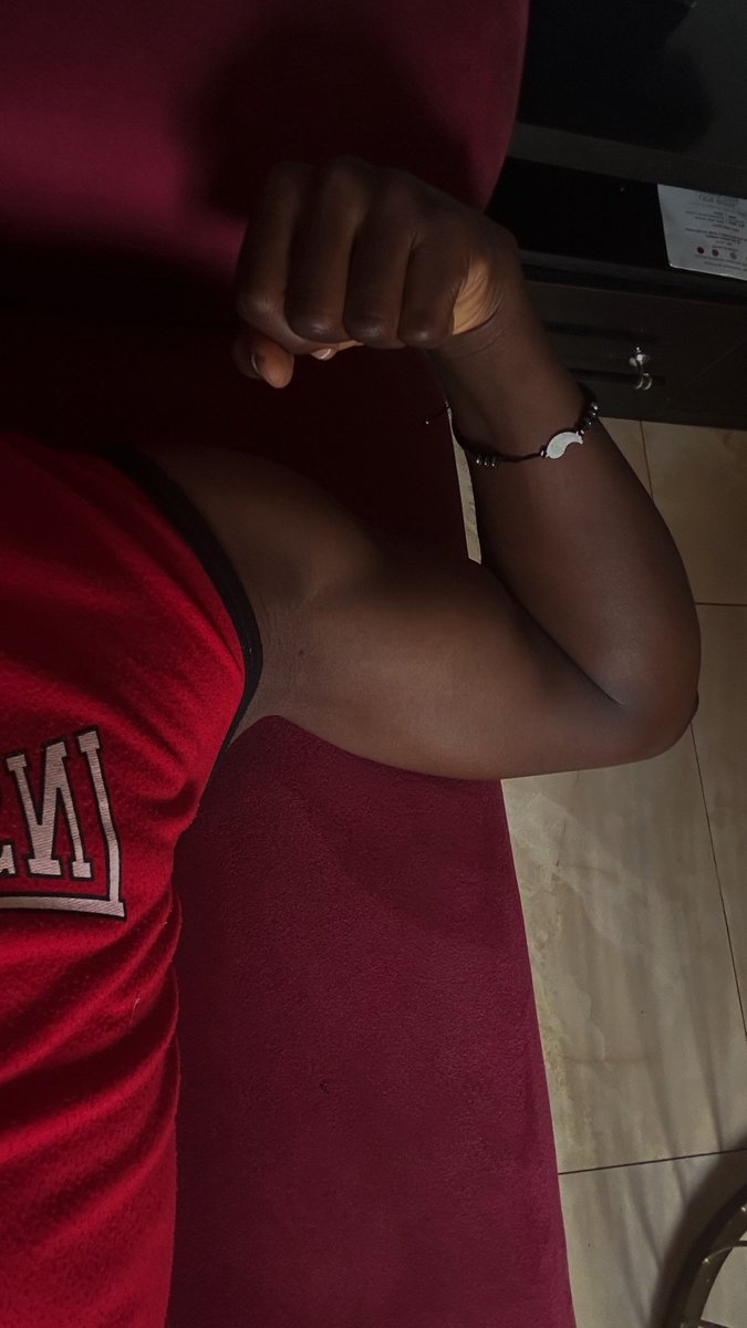 Jorgieverse's tweet photo. I love my birthmark so much https://t.co/Wi7TIUyVfF