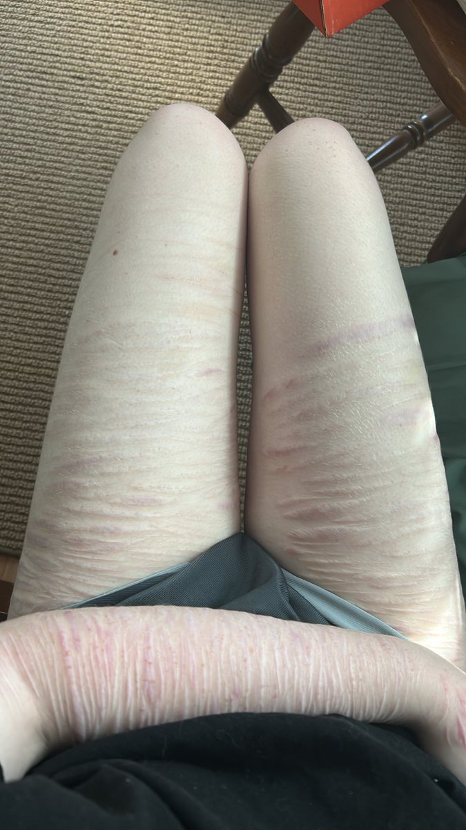 teethareboness's tweet photo. all fake ai enhanced sfx scars for medical teaching. upset when they fade; upset when theyre visible. #shrtwt #slittwt #beanstwt #raspberryfillingtwt #sillytwt #scars #sfx https://t.co/DCqSt54bj9