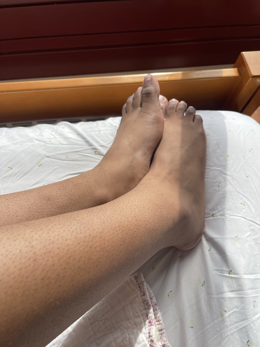 BulaTitti's tweet photo. hit me up daddiesss 
#feetworshi̇p https://t.co/n3PiuOCdFM