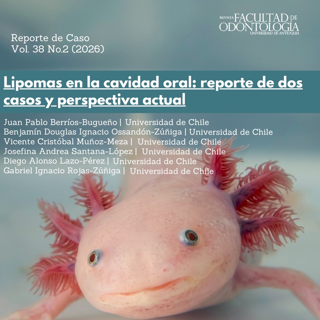 RevOdontUdeA's tweet photo. 🦷 ¿Qué tan frecuentes son los lipomas en la cavidad oral?

Dos casos clínicos ponen el foco en una lesión poco habitual.

🔎 Lee el artículo: https://t.co/XM2Whxfea9

#Odontología #CirugíaBucal https://t.co/mwkHTYaR1B