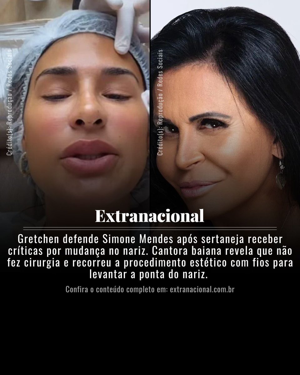 etnpop's tweet photo. Gretchen defende Simone Mendes após sertaneja receber críticas por procedimento estético no nariz. 

A íntegra, em Extranacional (@extranacionalbr)

#gretchen #simonemendes #nariz https://t.co/tv1DZslhPQ