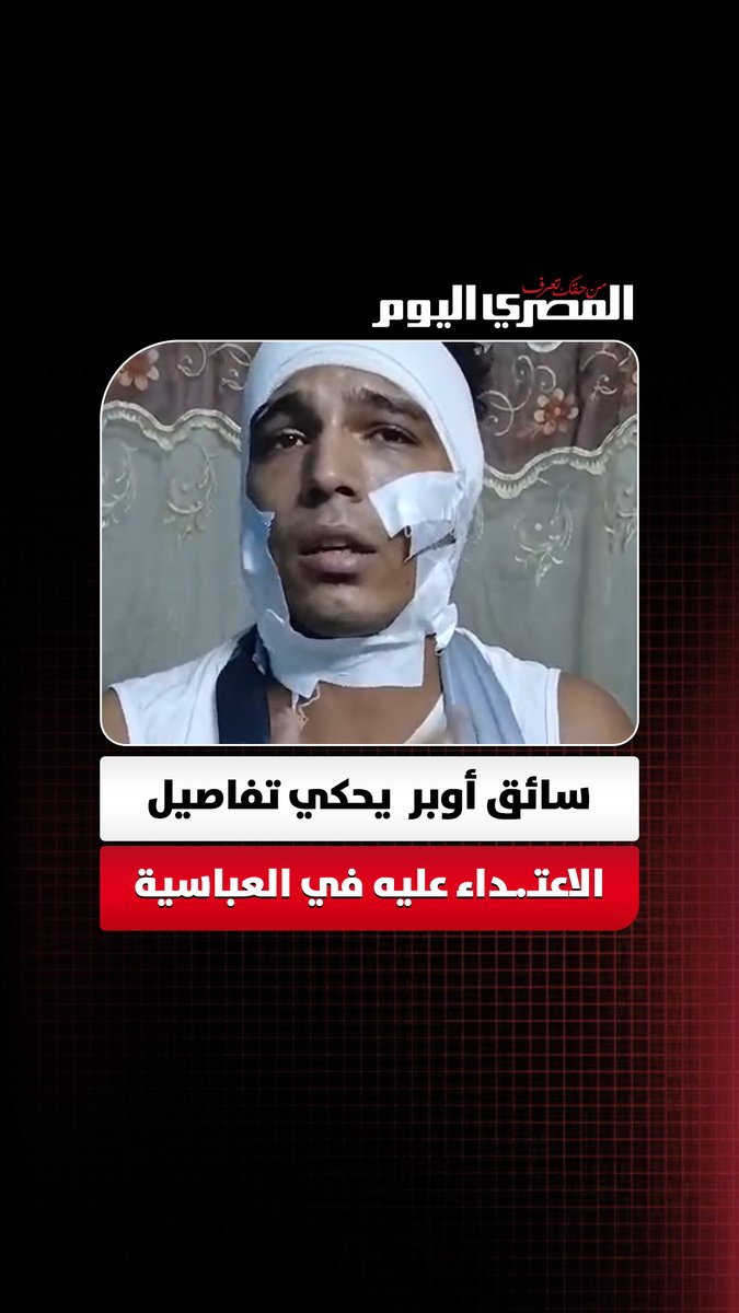 «انا انكسرت ومستقبلي ضاع ».. سائق أوبر يحكي تفاصيل الاعتـ.ـداء عليه في العباسية: «كانوا هيخلصوا عليا». تصوير: إيهاب عمران 