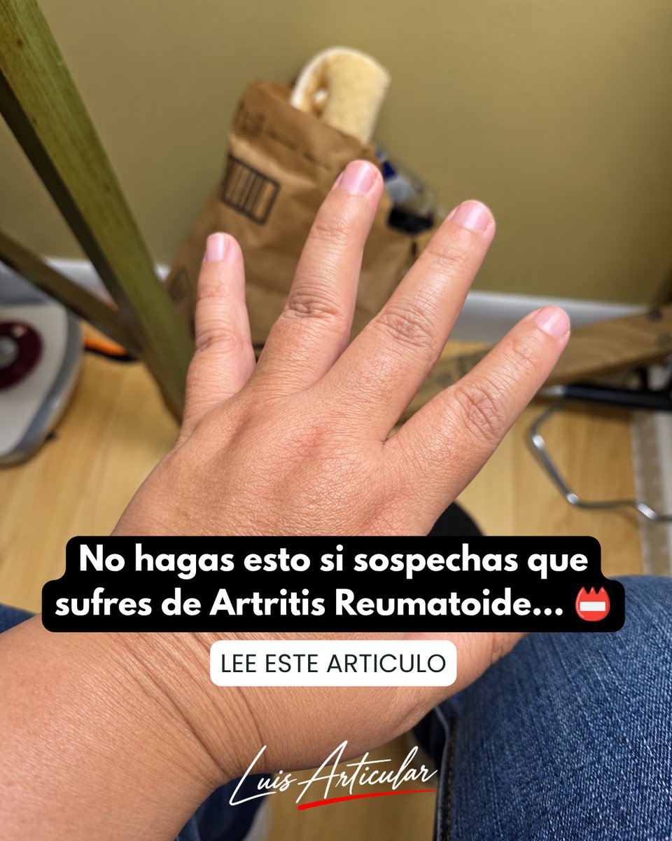 luisarticular's tweet photo. ⚠️ No esperes a que avance
ㅤ
Si sospechas artritis reumatoide porque tus manos se inflaman, amanecen rígidas o varias articulaciones duelen repetidamente, hay algunas cosas que NO conviene hacer.
ㅤ
Primero, no normalices la inflamación persistente. Un día de dolor después de una actividad intensa no es igual que varias semanas con nudillos inflamados y rigidez al despertar.
ㅤ
Segundo, no esperes a que los dedos comiencen a deformarse. 🖐️ La artritis reumatoide puede producir daño articular progresivo cuando la inflamación permanece activa, por eso la evaluación temprana importa.
ㅤ
Tercero, no mantengas las manos completamente inmóviles. Durante una etapa dolorosa puedes disminuir tareas exigentes, pero los movimientos suaves ayudan a conservar función.
ㅤ
Cuarto, no hagas ejercicios intensos pensando que debes “vencer” la rigidez. Una articulación muy inflamada necesita una carga diferente a una articulación estable.
ㅤ
Quinto, no pienses únicamente en las manos. Observa muñecas y pies. La artritis reumatoide puede afectar varias pequeñas articulaciones y frecuentemente existe un patrón en ambos lados del cuerpo.
ㅤ
Sexto, no dependas de dietas extremas o productos que prometen eliminar la enfermedad. Una alimentación equilibrada puede acompañar el cuidado general, pero no reemplaza la evaluación de una inflamación articular persistente.
ㅤ
¿Qué puedes hacer hoy? 📝 Registra qué articulaciones se hinchan, cuánto dura la rigidez después de levantarte, qué actividades empeoran los síntomas y si existen días claramente mejores o peores.
ㅤ
Adapta tareas cotidianas. Si abrir frascos, escribir durante horas o cargar bolsas dispara el dolor, reduce el esfuerzo y distribuye la carga.
ㅤ
Y mantén actividad física dentro de tus posibilidades. Movimiento adaptado, descanso suficiente y alimentación equilibrada son aliados importantes para conservar función.
ㅤ
No necesitas esperar a que tus manos cambien de forma para tomar en serio la inflamación.
ㅤ
Para seguir aprendiendo sobre artritis reumatoide y cuidado de tus articulaciones, visita el enlace de mi perfil.
ㅤ
#SaludArticular