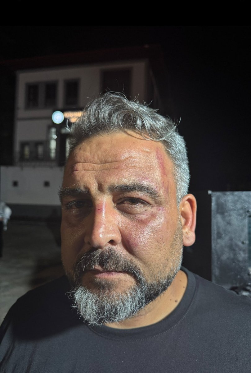 FarukDinc_'s tweet photo. Rize’de siyonist israil'e destek veren Burger King firmasını barışçıl bir şekilde protesto eden vicdan sahiplerinin saldırıya uğraması kabul edilemez!

Sumud Filosu aktivisti Samed Turan ve öğretmen Adem Pınar; Filistin gönüllüsü aktivistlerimizin darp edilmesine ve kaçırma teşebbüslerine maruz kalması, Siyonist cürretkarlığın memleketimizde de sergilenmeye çalışıldığının açık bir göstergesidir.

Zulme uğrayan Vicdan sahiplerini selamlıyor, düzenlenen saldırıyı şiddetle kınıyorum.

Yapılan bu saldırının hesabı hukuk önünde sorulmalıdır.