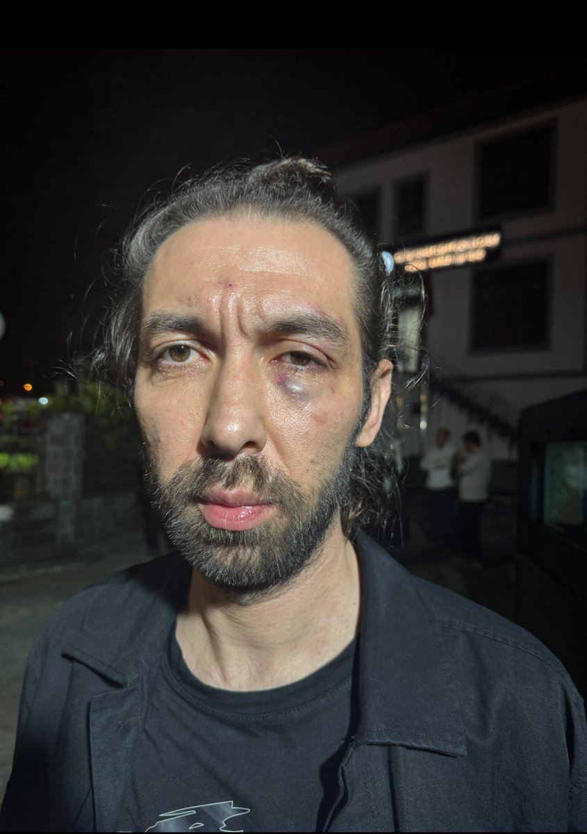 FarukDinc_'s tweet photo. Rize’de siyonist israil'e destek veren Burger King firmasını barışçıl bir şekilde protesto eden vicdan sahiplerinin saldırıya uğraması kabul edilemez!

Sumud Filosu aktivisti Samed Turan ve öğretmen Adem Pınar; Filistin gönüllüsü aktivistlerimizin darp edilmesine ve kaçırma teşebbüslerine maruz kalması, Siyonist cürretkarlığın memleketimizde de sergilenmeye çalışıldığının açık bir göstergesidir.

Zulme uğrayan Vicdan sahiplerini selamlıyor, düzenlenen saldırıyı şiddetle kınıyorum.

Yapılan bu saldırının hesabı hukuk önünde sorulmalıdır.