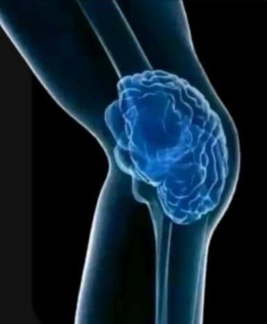 LodeSeMere's tweet photo. Someones brain in it need fame for the operation https://t.co/PlwUQYWLDc