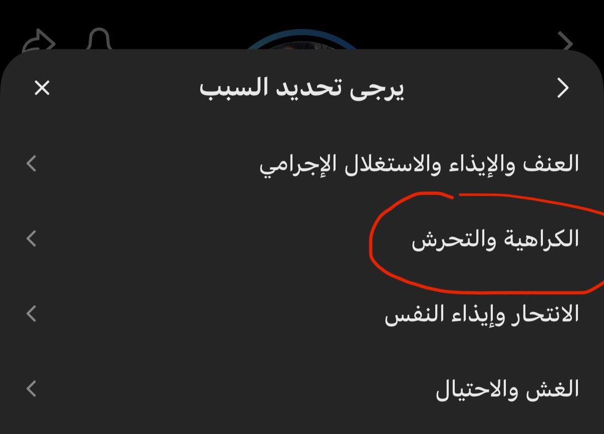 forbeinlov's tweet photo. اكتبوا ( أرغب بالإبلاغ عن هذا الحساب بسبب قيامه بنشر مقاطع تتضمن تنمرًا وإساءة متكررة تجاه شخصية مشهورة، واستخدام عبارات مهينة وساخرة بقصد التقليل منها والتحريض عليها. أرجو مراجعة المحتوى واتخاذ الإجراء المناسب وفقًا لإرشادات مجتمع TikTok ) 

🛑يوزر الفسيخ : mostafamahmoud26798🛑 https://t.co/L0EY5S7eCA