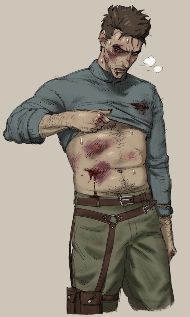 xn0regiax's tweet photo. (CW blood/injury) How Artemy was looking Day 1 or even Day 2 probably. Maybe. https://t.co/vGpEj7Xysh