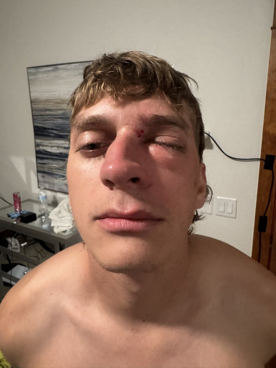 pauciCyclops's tweet photo. @hasanthehun @officernasty70 @IRL_Darius Right after this he brutally assaulted someone else

https://t.co/EHNkCKF59v https://t.co/nFqAYl0oK7
