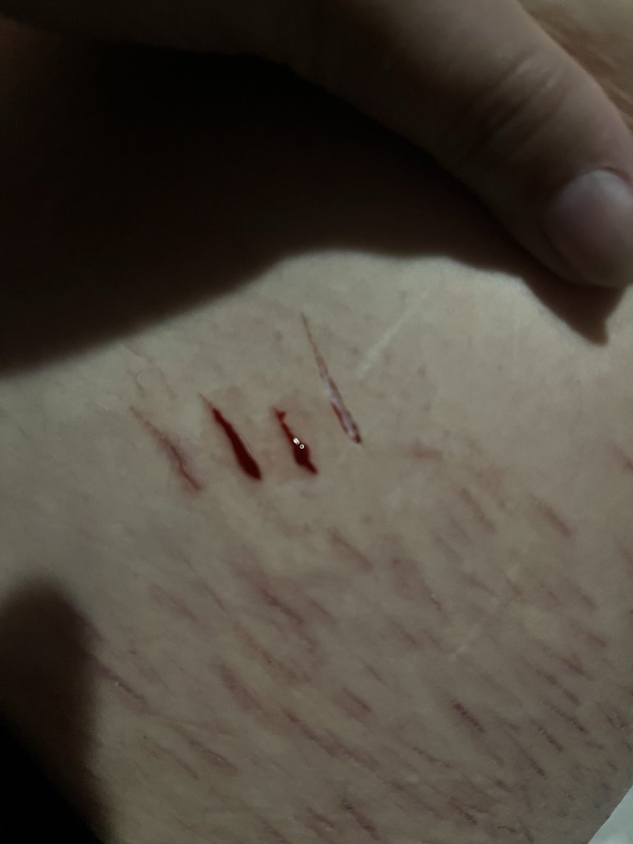 Milorgci's tweet photo. I could go one day clean im so stupid. https://t.co/abajq75FRp