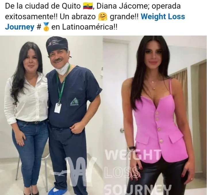 Lavernierrx's tweet photo. @EduardoBr77 La Que es 🐷🥓de genética , MARRANA DE GENETICA SE QUEDA! por más cirugías de Extracción de Manteca que se haga,el ADN no miente,Una verdadera flaca no anda llendo a cirujanos ni haciendo dietas, una flaca real se Come 8 empanadas sin culpa, estás toman agua y explotan el disfraz https://t.co/dRlvGvf2Uc