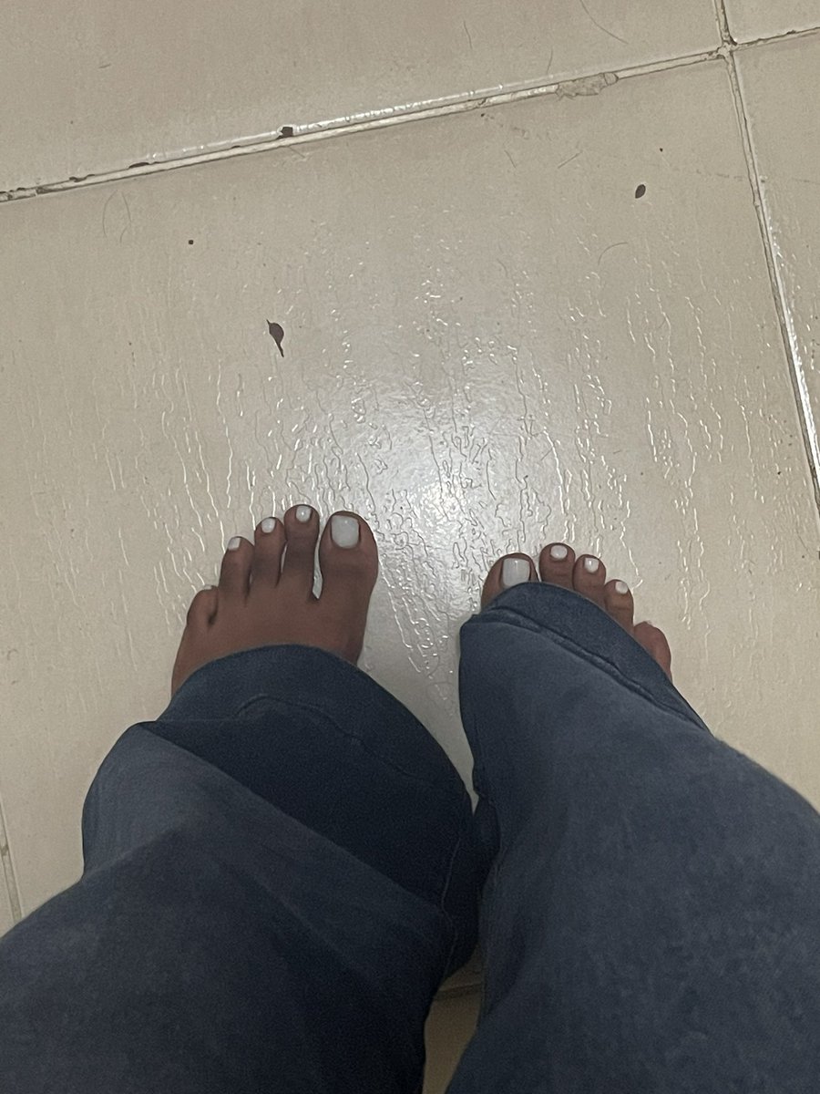 sbamy19's tweet photo. milky white toes >> https://t.co/0F4Hfp7wdt