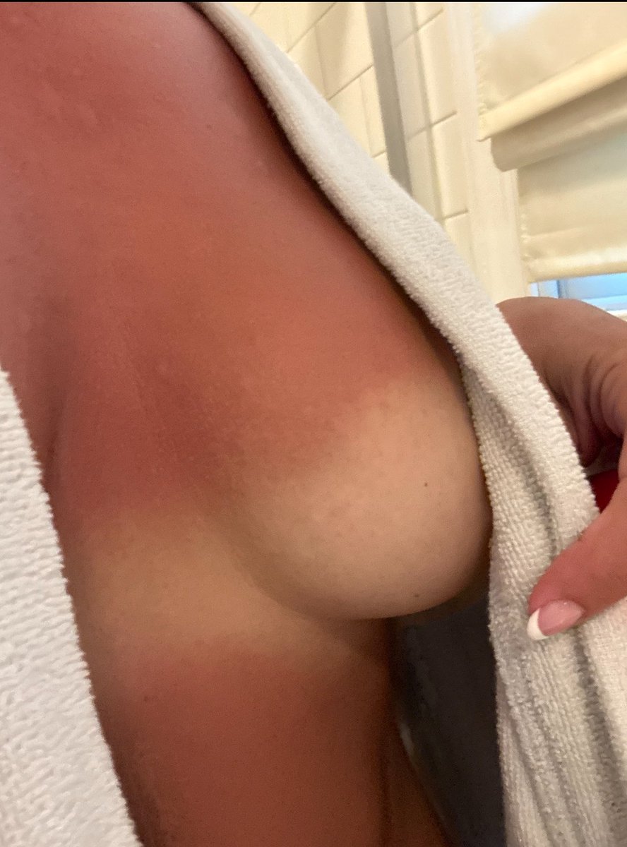lovestobeshared's tweet photo. ☀️ Long summer. 
👙Fresh tan lines. 
💦 Missed you all.

The uncensored version is on OnlyFans 😈

Link in bio 👆 

#tanlines #onlyfans #boobies #slut https://t.co/rKPEemqLmK