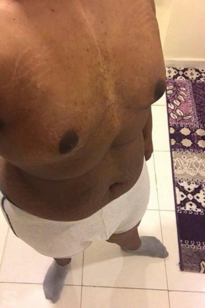 Tyical_'s tweet photo. ابي مبادل او سالب نحيف انا مبادل حنان اميل موجب اسمر دب من جده الجاد ينط خاص ويختصر بصوره والمكان موجود لايك بلوك تابعني عشان تقدر ترسل خاص https://t.co/LTEA0f1ku2