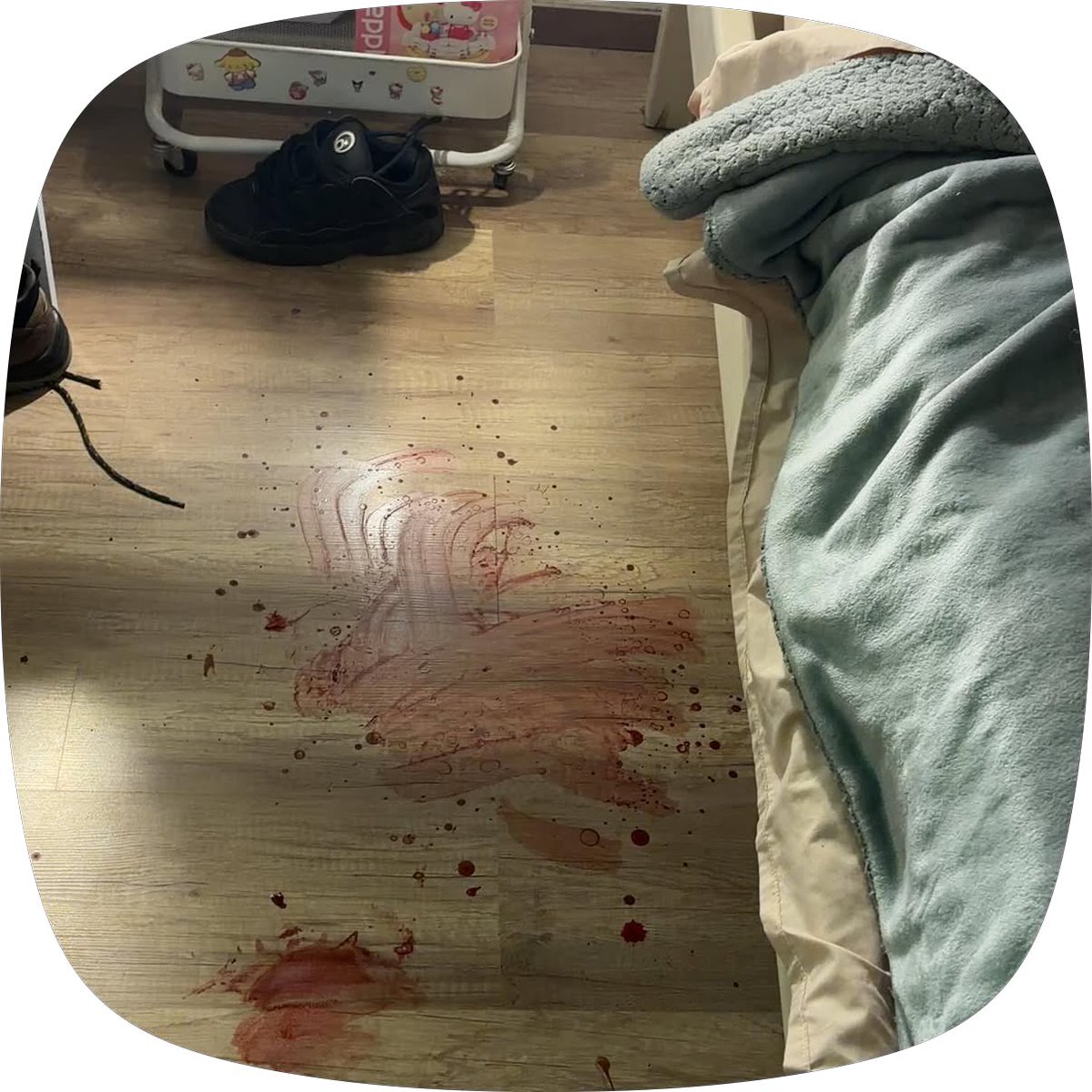teamtetas2008's tweet photo. #fakeblood (*≧ω≦*) https://t.co/moUuH9G42i