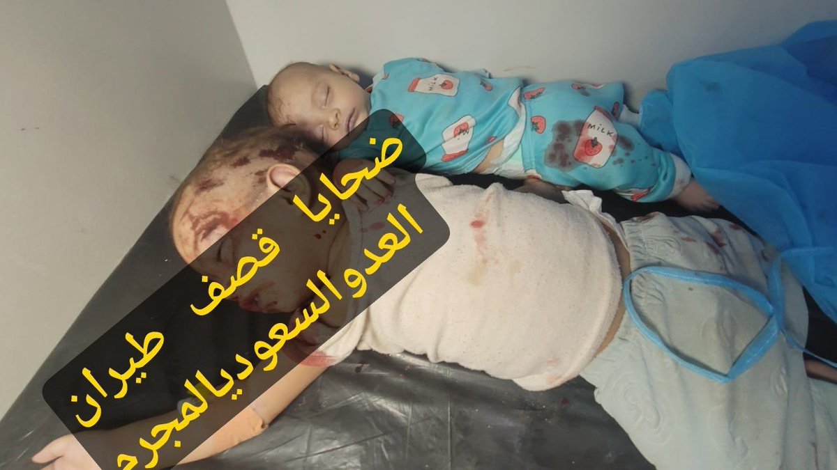 GhfraaaanA's tweet photo. استشهاد 6 مواطنين بينهم طفلان وامرأة وإصابة ثمانية آخرون بينهم طفل وامرأة إثر غارات العدو المجرررام  السعودي على المخا بمحافظة تعز https://t.co/Qkl8QsQ5Ag