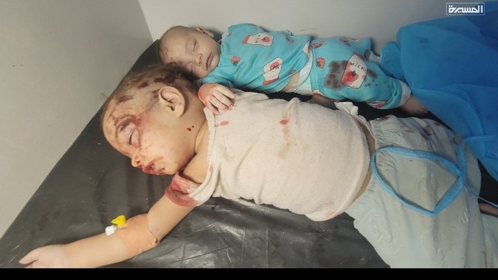m_a__2022's tweet photo. @SAM_1YE طائره وهاذا بتعز الان طري

وايضا مدني في حيفان ماقدرت ارسل صورته منضر بشع😢 https://t.co/C7mPG3lTrr