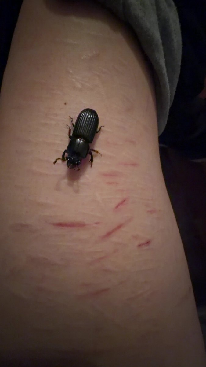 StarW0ven's tweet photo. I love bugs guys look at the cool bug and HEALED SCARS twt get off my dih https://t.co/K7FFUeoO0P