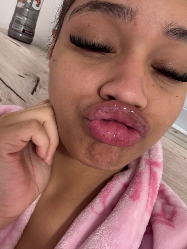 LIPSnBADDIES's tweet photo. lightskin baddie trin with glossy plumpers ๐ฏ๐ฆ
-
#lips #lipgooner #DSL #biglips #lipfetish #nutty #gooner #gooning #faceporn #goonfuel #juicylips #glossy #glossy #pyt #fineshit #baddies #lipgloss #kisses #lightskin #goon #ebonydsl #goony #plumps #plumpers https://t.co/5hsyISSt0p