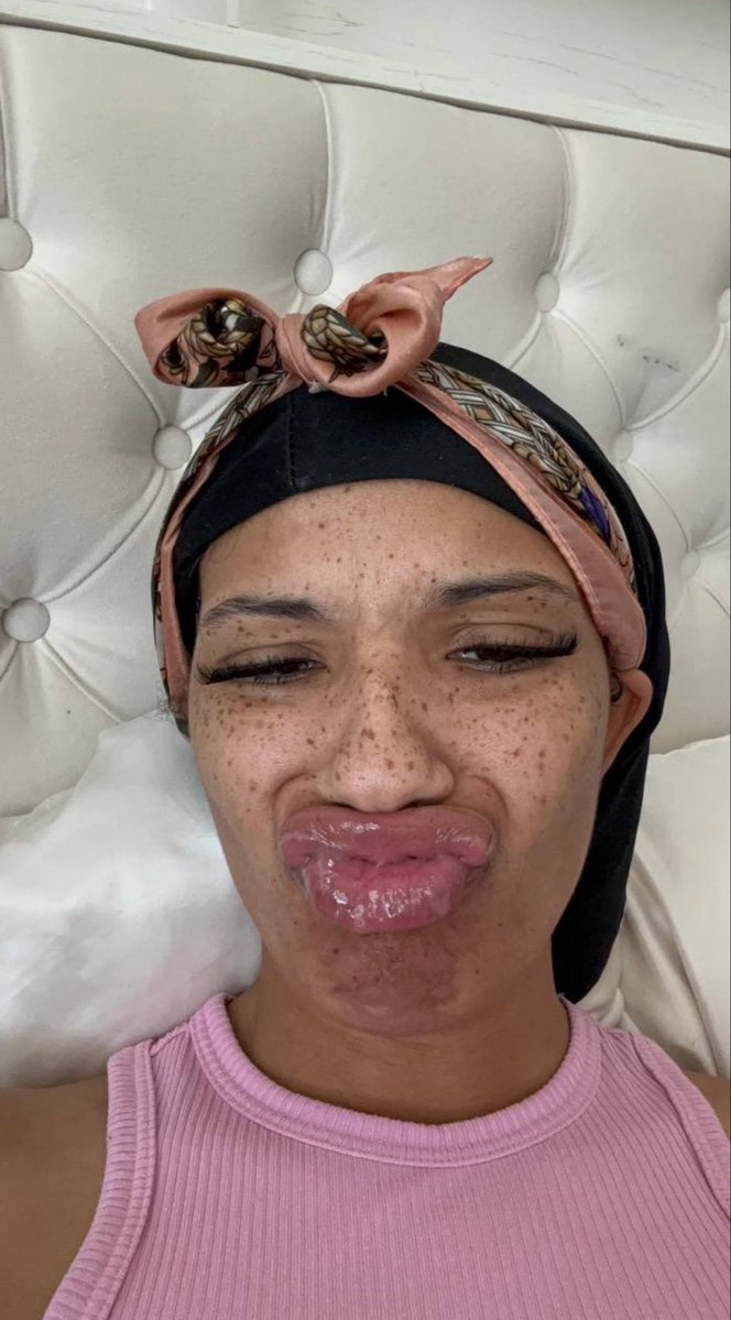 LIPSnBADDIES's tweet photo. nutty freckled lightskin baddie with DSLs ๐๐ตโ๐ซ
-
#lips #lipgooner #DSL #biglips #lipfetish #nutty #gooner #gooning #faceporn #goonfuel #juicylips #glossy #glossy #pyt #fineshit #baddies #lipgloss #kisses #freckles #goony #goon #ebonydsl #spit https://t.co/rVDSv8N9xL