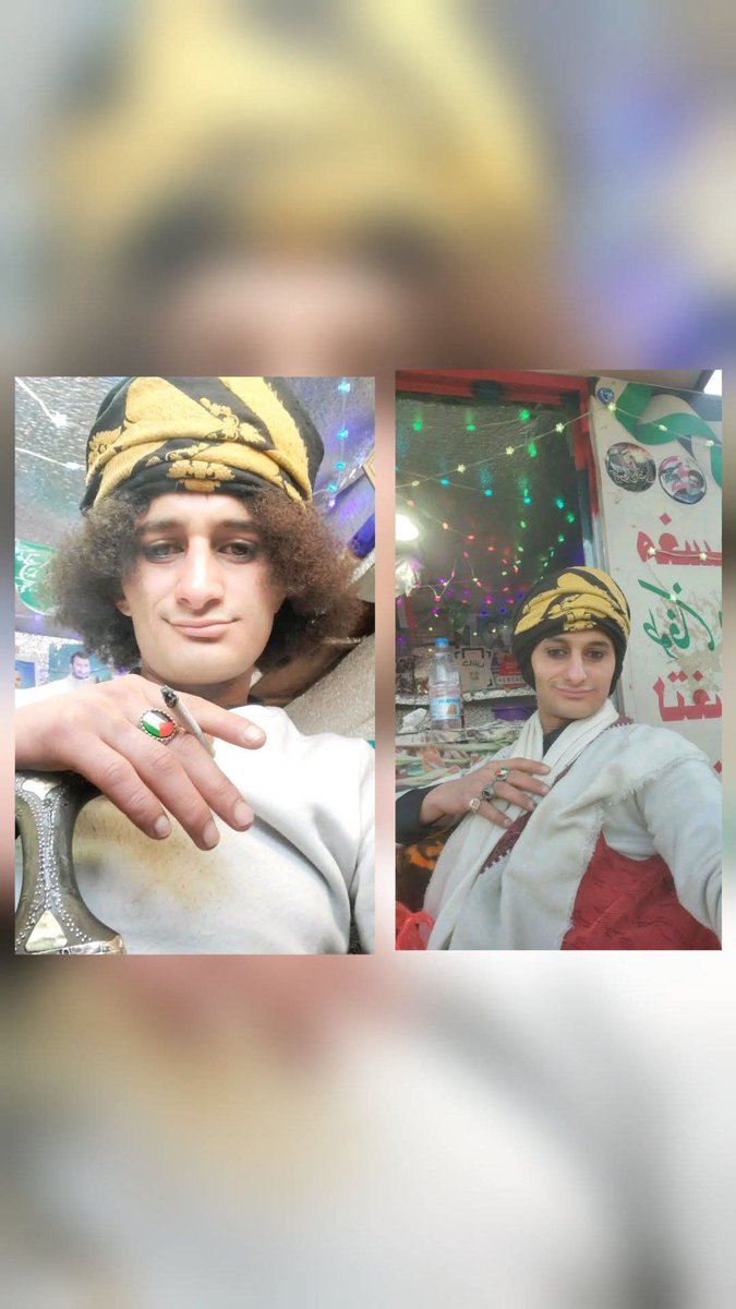 abw7badr's tweet photo. @AgMoaz @JaLeute @Columbuos بالنسبه للذي بشرتهم سودا 
في التحقيقات طلع انه ضرب ولدهم الصغير 

بالنسبه لشخص اخر يضربه فهو اخوه الناس راحت تشتكي لاخوه الكبير يضبطه من المشاكل 

وبعدين هذا شخص سيء السمعه يعمل مكياج ويخرج الشارع 
موضوعه عند الجهات الامنيه 
بعض التصوير يعود لفتره 2024 او 2025 عاده ينشرها اليوم https://t.co/qCwhaYU1vx