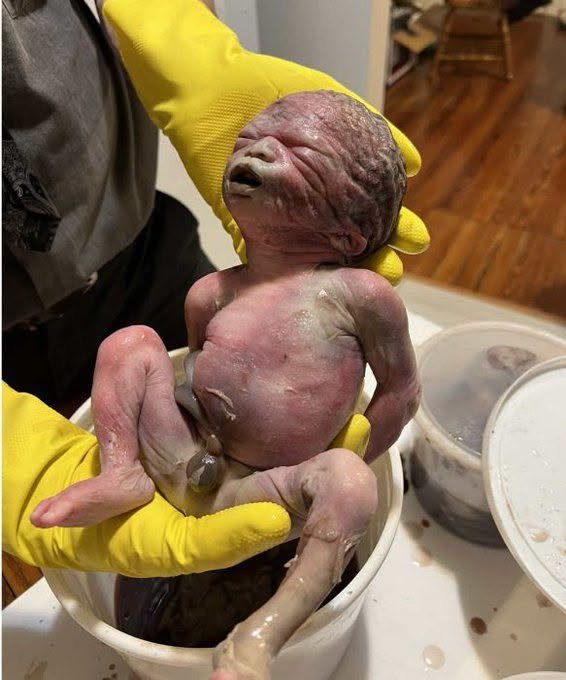 GeneosDenise's tweet photo. This is what a third trimester abortion looks like https://t.co/euNYDvDW6u