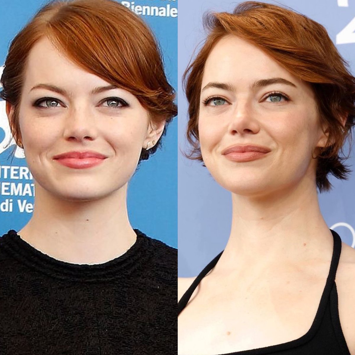 ghostieshoodie's tweet photo. Leave Emma out of this, you keep accusing her when she didn’t have a facelift… she admitted to skincare https://t.co/02VZQcY3Vs