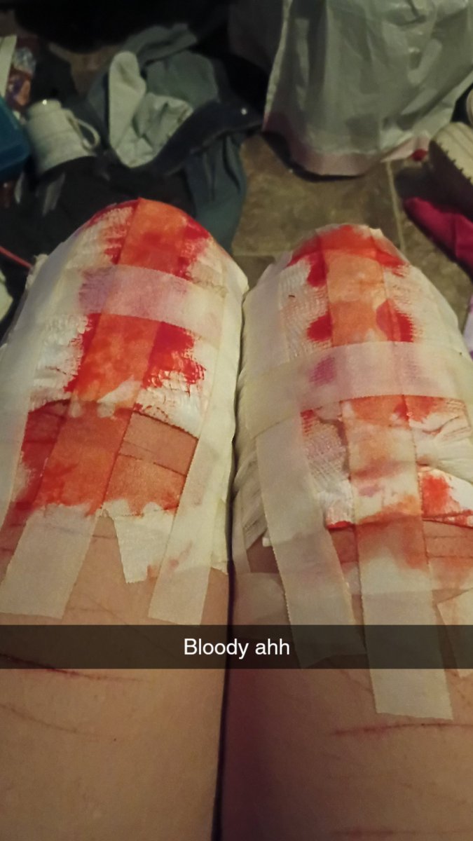 uhmmmidkkkerzy's tweet photo. SFX MAKEUP AND AI GENERATED
OUUU SHIII https://t.co/ifyeDCNPyg