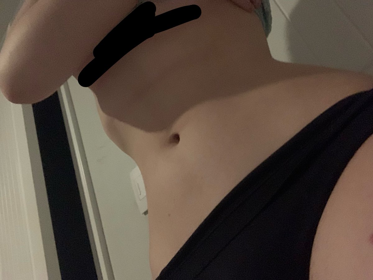 Satoukyu's tweet photo. trying this again! 😭 first photo from 3 days ago? then last ones from 2 days ago, i think.. covering scars cus twitter will kill me again #edrtwt #edtwt #shedtwt https://t.co/WHLAdQQ40X