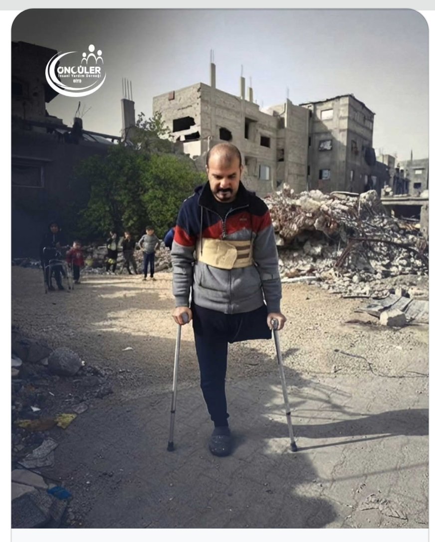 Ferdi_Karabasan's tweet photo. Gazze’de binlerce insan, uzuv kaybı ve kalıcı engellerle savaşın ağır sonuçlarını bedenlerinde taşıyor. 

Savaş bittiğinde bile, bazı izler ömür boyu kalacak. https://t.co/ko0tTUkqSo