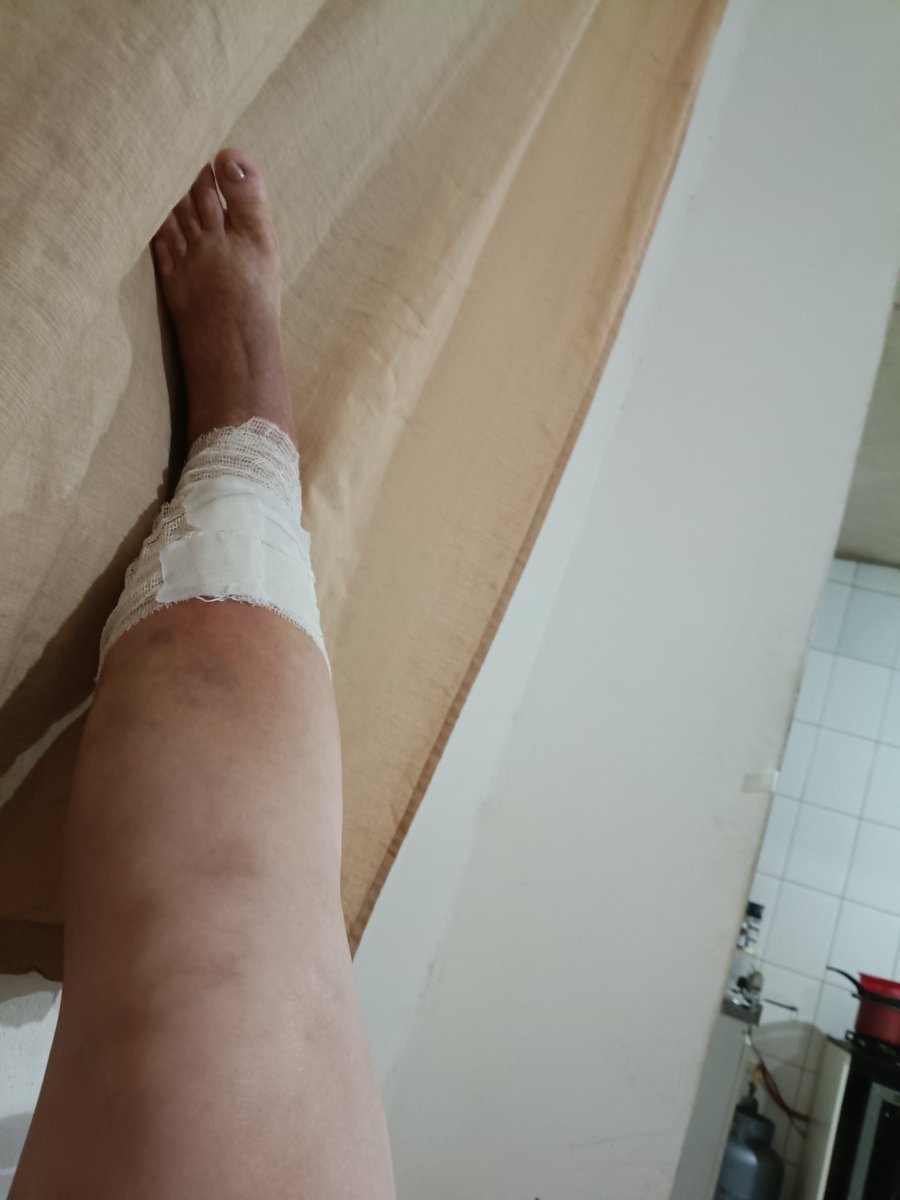 TatianeFeitos's tweet photo. Não aguento mais esta dor na minha perna, não sei o que fazer mais, um gasto absurdo, INSS não marca a perícia, consulta com cirurgião vascular dia 26/09, resultado da biópsia só depois do dia 06/10,  acabei de tomar um Dorflex duo pra ver se ameniza um pouco. Quero a minha vida de volta 😭
Amigos vai dar tudo certo 🥺