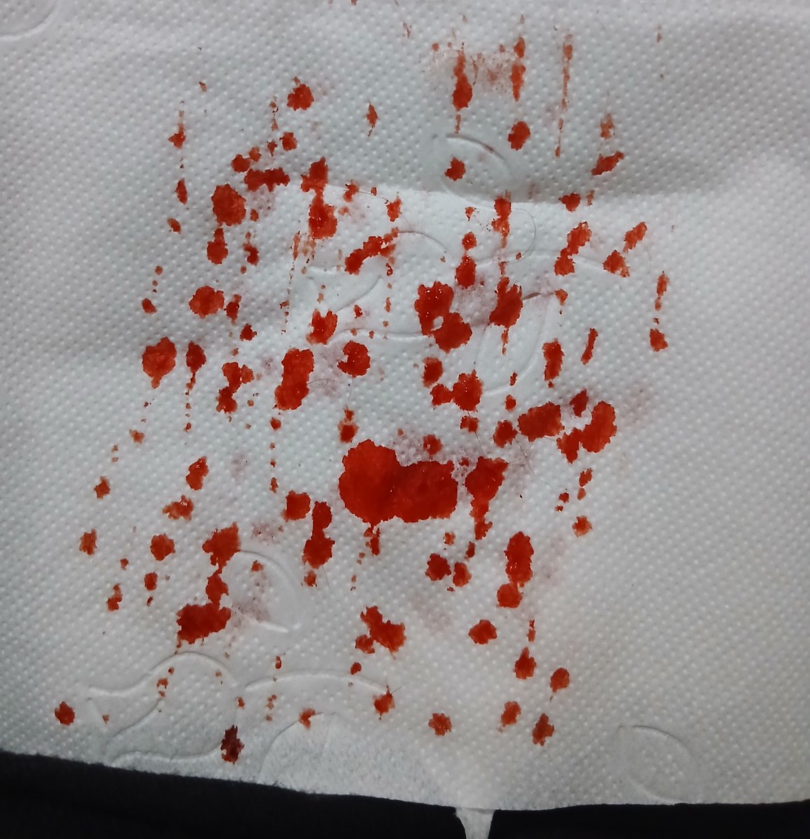 Themeteorishere's tweet photo. #slittwit I like when the paper looks like this
makeup for Halloween! https://t.co/HccMx65sNc