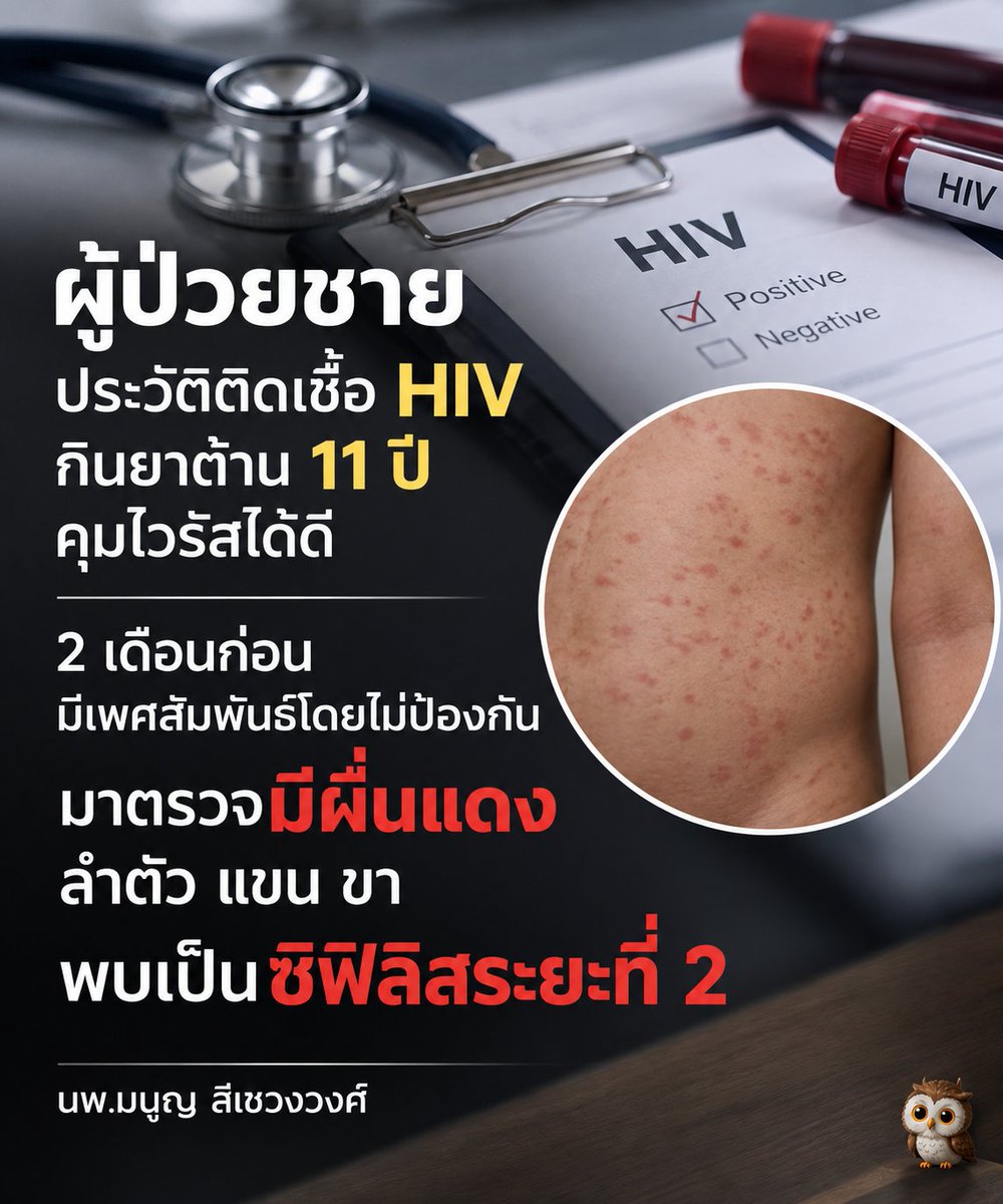 skongki2000's tweet photo. เป็นสิ่งที่ควรระวังและป้องกันด้วยจะดีที่สุด ถ้าเราใช้ชีวิตแบบไม่ประมาทก็จะไม่มีใครทำอะไรเราได้นะครับ https://t.co/qAFOMmhmeN