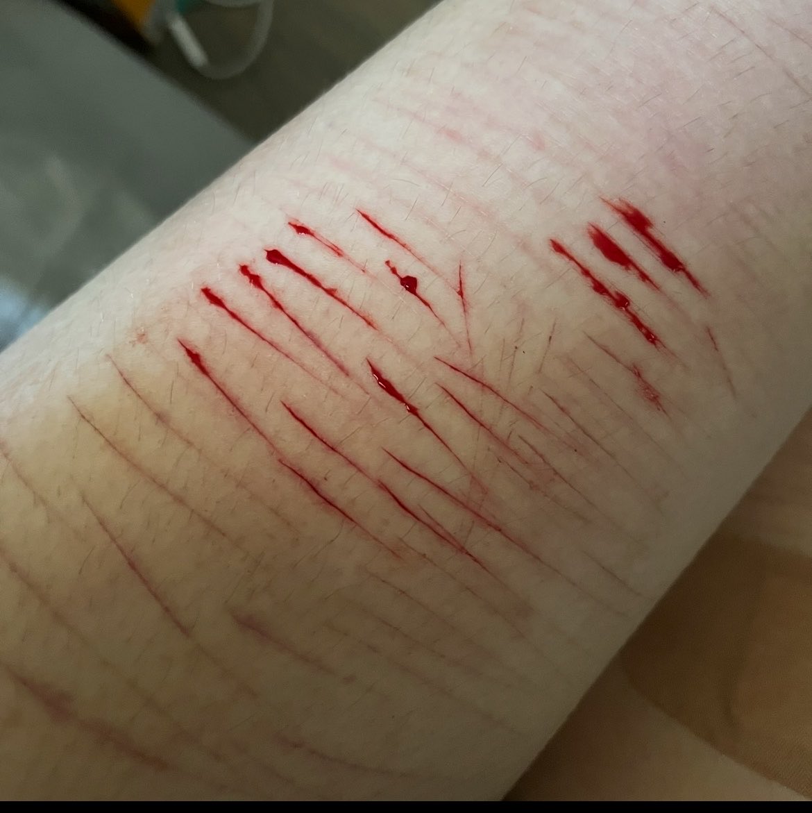 dietknight_'s tweet photo. !! all sfx makeup, fake blood !!

fav cuts from last year
#shtwtt #shedtwtt #scarspo https://t.co/Oy6fTKyg7h
