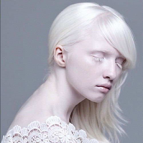 StayScope's tweet photo. Albino people are so beautiful, aren't they? https://t.co/s1HRnsxOPp