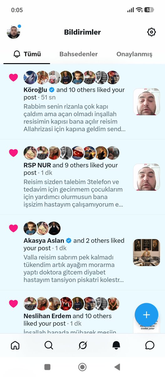 FeyzullahDp9's tweet photo. Begenlerden Rabbim razı olsun inşallah bukadar gören var beğeni yapan var ama reisim beni görmüyor duymuyor videolarımi görmüyor hatamı yapıyom diye düşünüyorum tek cabam sana destek olmam bide yardım istemem ayağım morarmaya başladı diyabetten @sedat_peker @hizirreis999 https://t.co/mMSvxo32lE