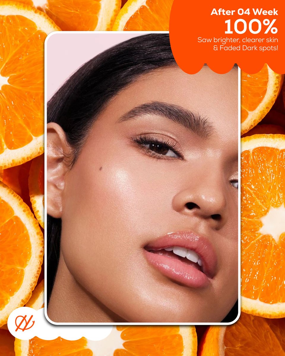 JoselynLayul00's tweet photo. 4 weeks. A 100% difference. Brighter, clearer skin and visibly faded dark spots—that’s what consistency looks like. Ready to see your own transformation? https://t.co/uIg0JoQfqG