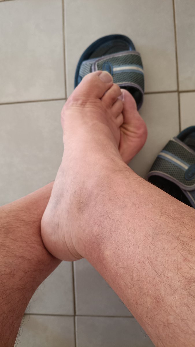mysweetmalefeet's tweet photo. Everyday feet.
More feet? Link in bio

#feet #feetfetısh #feetpic #feetpicforsale #sellpic https://t.co/tyL8I4Qrwp