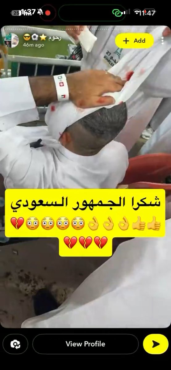 NFCoqu8's tweet photo. @87salem_ فلقنا راسه وش بتسوي https://t.co/ZkArnk6DwT