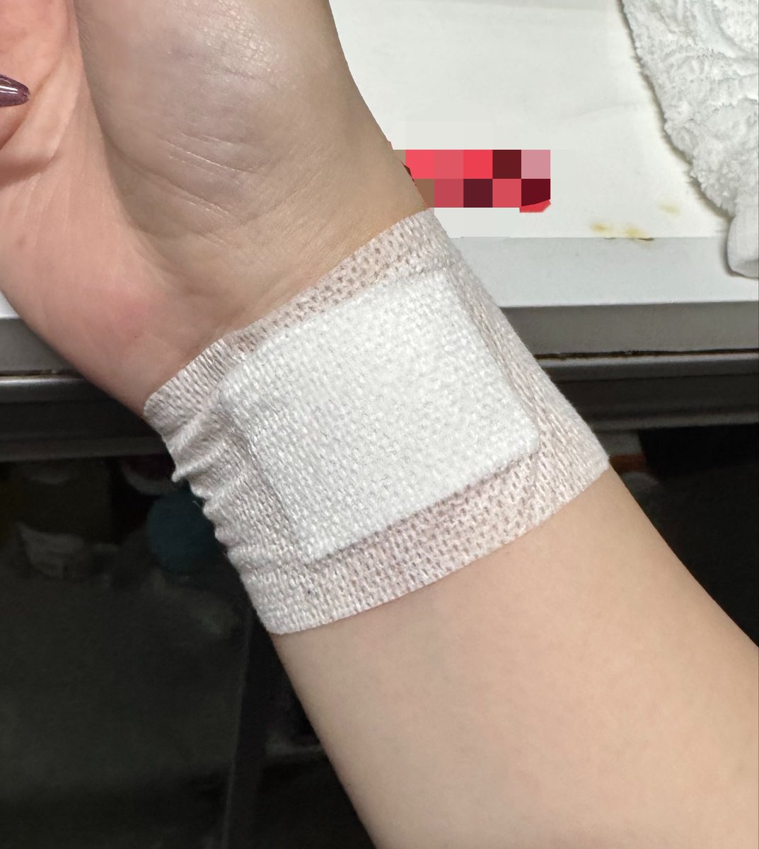 ryoxxpii's tweet photo. ダニかなんかに刺されたところめっちゃ腫れてて薬塗ると広範囲だしベタベタしちゃうから上からガーゼ貼ったらお客さんにリスカ？って言われてしんだ
聞いてきたやつもノンデリだけど何も言わずに勘違いされてるよりは聞いてくれて逆に反論できるから良かったわ😹 https://t.co/i3w07H0Kzm