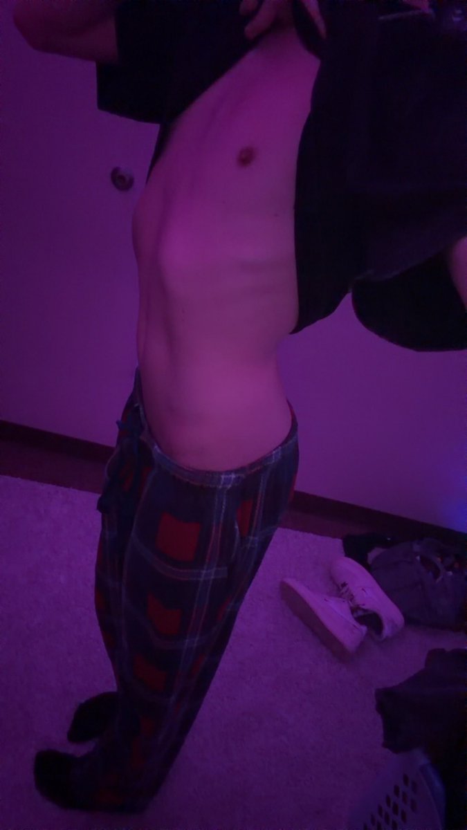 amofemm's tweet photo. my tummy hurt #femboy https://t.co/Dk0Vc8awvp
