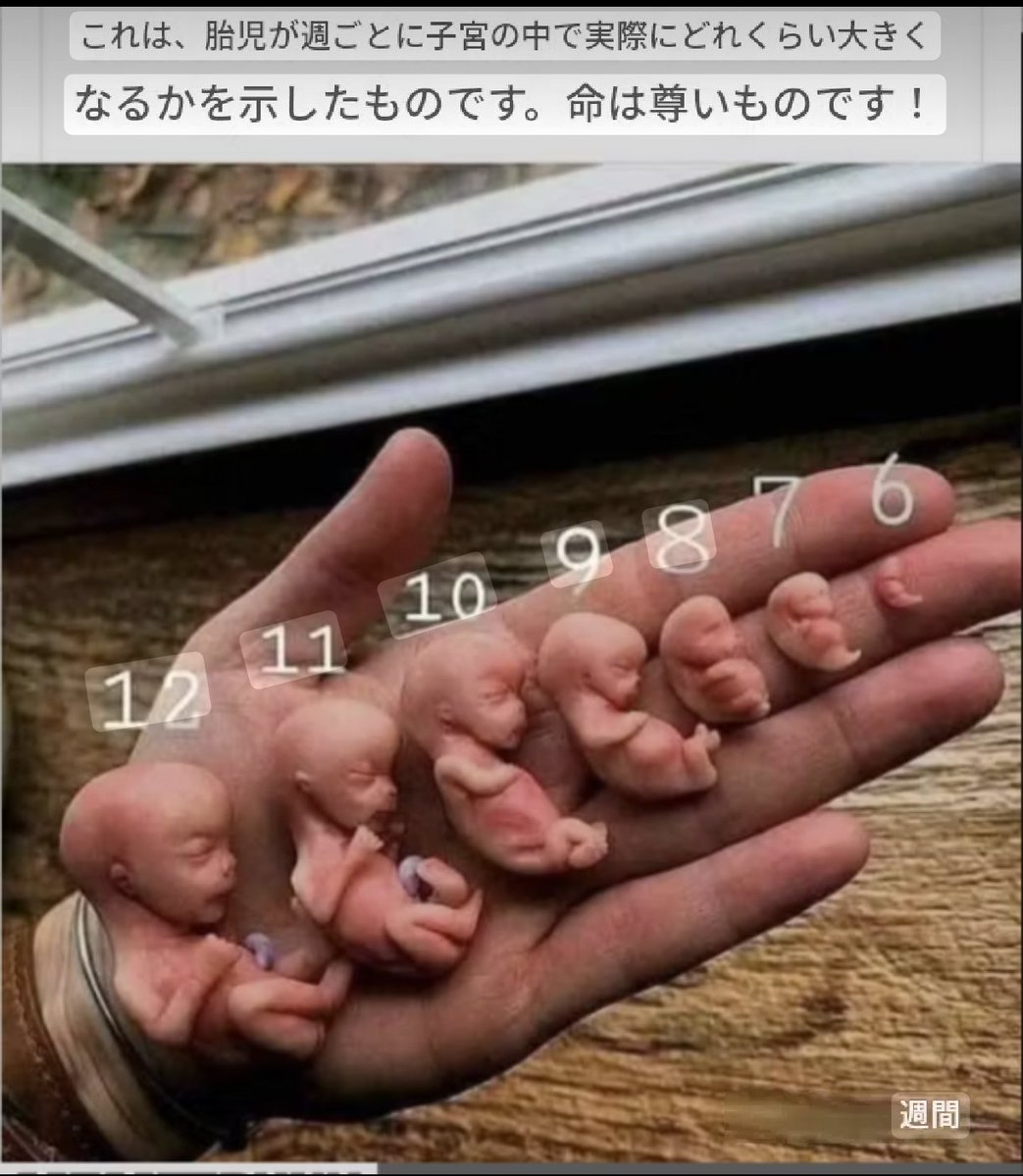3whUdFZab820806's tweet photo. ABORTION IS MURDER. 

#StopGroomingOurKids #StopHumanTrafficking 
#Pizzagate #AbortionIsMurder
#PedoGate #PodestaEmails
#FRAZZLEDRIP #StopChildTrafficking 
#DeathPenaltyForPedophiles
#EndHumanTrafficking https://t.co/DJ8W0NWvvW