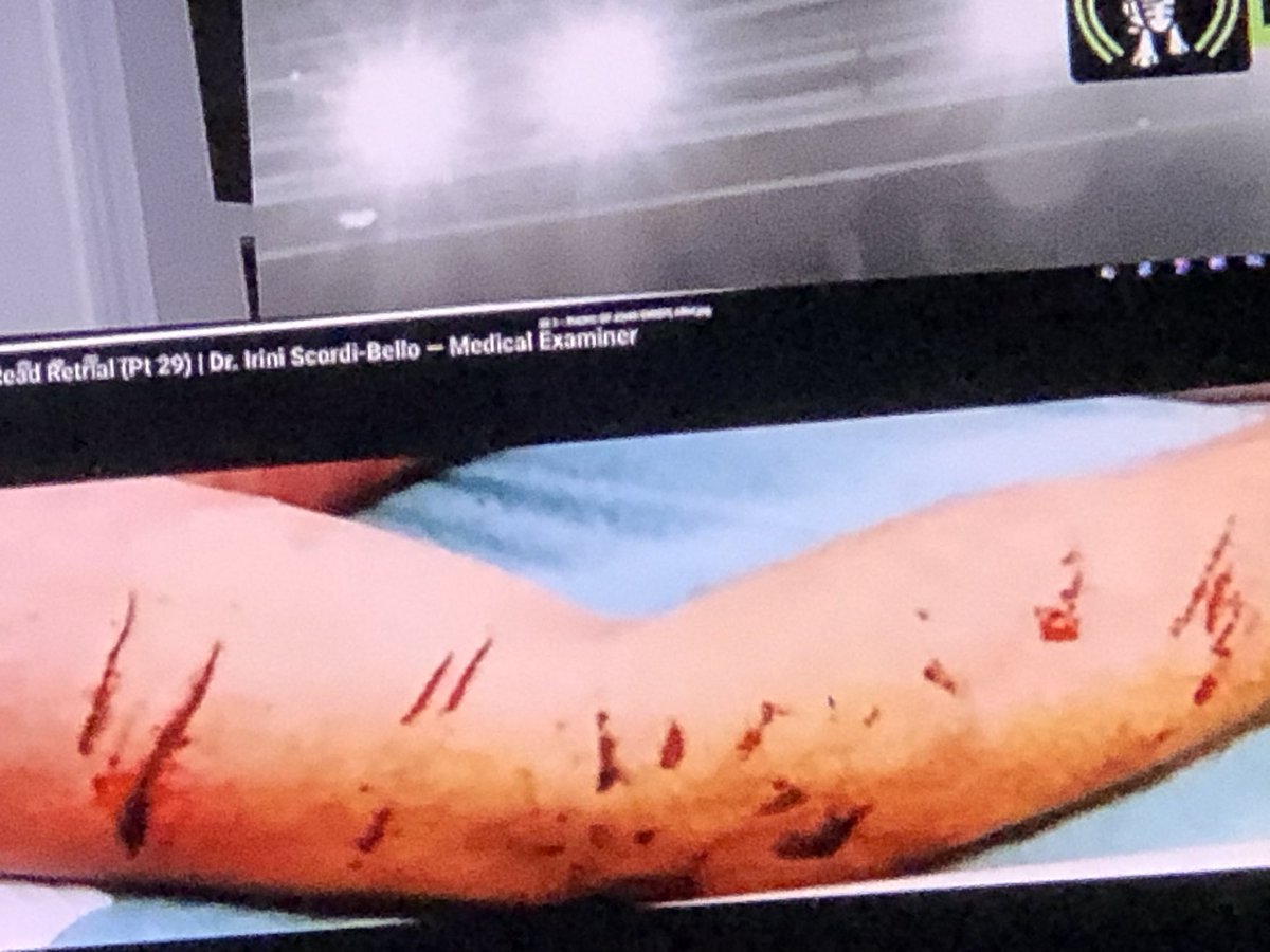catwoman_1111's tweet photo. @Colleen7227 @_Kaustik_ @realjustsully @FBIBoston I’m not the one that thinks a @Lexus taillight did this 👇🏼to #JohnOkeefe I have been brought up w dogs! I’m the female version of @cesarmillan also psychic talk to JO daily your all doomed like Ken, Mello say hello to Kaci Gillis 😂 watch the kiddies around Terry Kent https://t.co/n9eA2JQZod