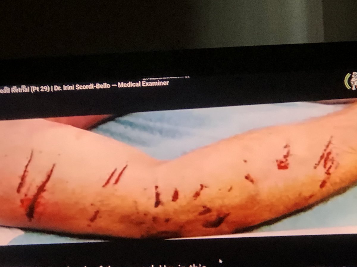 catwoman_1111's tweet photo. @Colleen7227 @_Kaustik_ @realjustsully @FBIBoston I’m not the one that thinks a @Lexus taillight did this 👇🏼to #JohnOkeefe I have been brought up w dogs! I’m the female version of @cesarmillan also psychic talk to JO daily your all doomed like Ken, Mello say hello to Kaci Gillis 😂 watch the kiddies around Terry Kent https://t.co/n9eA2JQZod