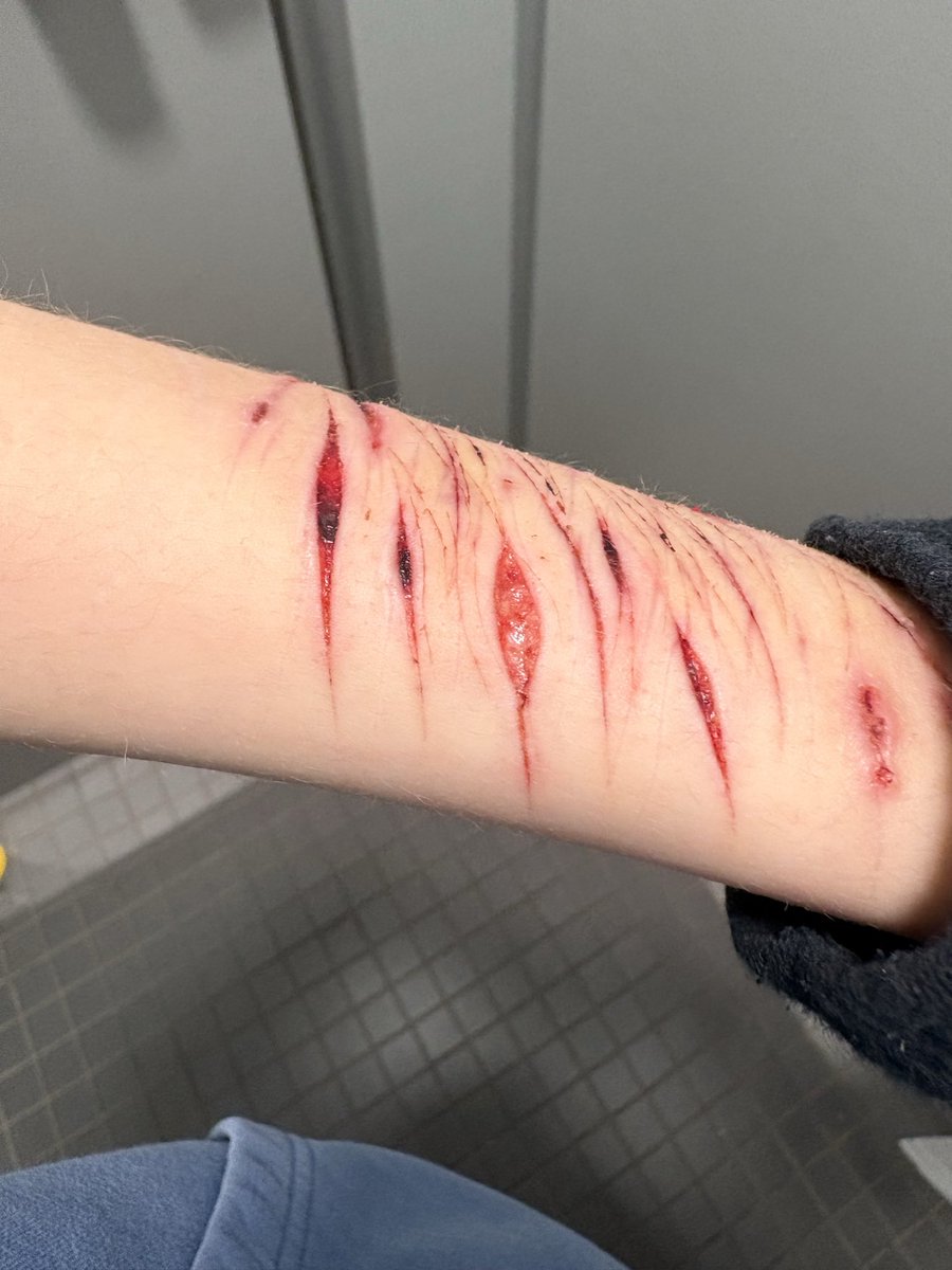 4t3rg's tweet photo. You know your sfx makeup is good when you get temporarily banned 😛
‼️⚠️Sfx makeup all fake fake body fake blood fake everything‼️⚠️
Halloween makeup practice 
#shtwt #shrtwt https://t.co/kVSytNFdRG