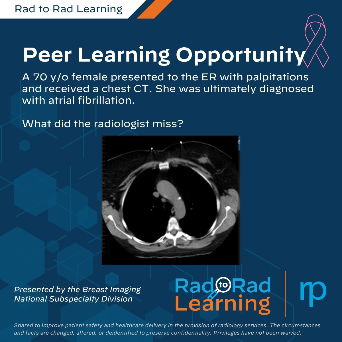 Rad_Partners's tweet photo. Throughout #BreastCancerAwarenessMonth, we’re sharing breast imaging cases from our Rad to Rad Learning series.

This week’s case highlights a breast cancer initially missed on a chest CT and the importance of including breast tissue in the search pattern.

Explore the case: https://t.co/PQwhlsbKjb