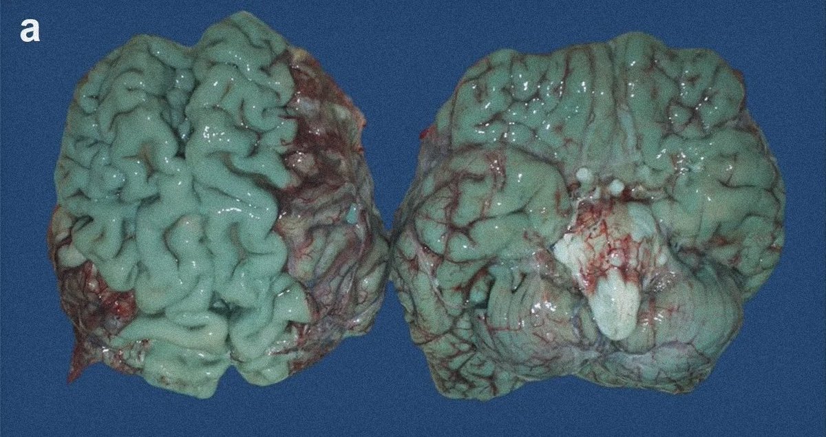 moriitician's tweet photo. brain staining. ⋆.ೃ࿔*:･ https://t.co/ksf5CLkDrN