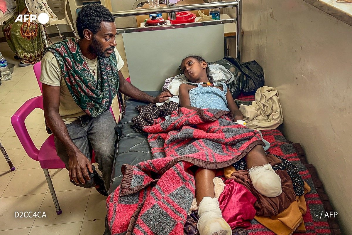DilNaodA's tweet photo. 10 year old Eyerusalem is a double amputee as a result of indiscriminate shelling of #Tigray by the genocidal Abiy Ahmed. 

#TigrayGenocide https://t.co/Ubnwc2y5Xv