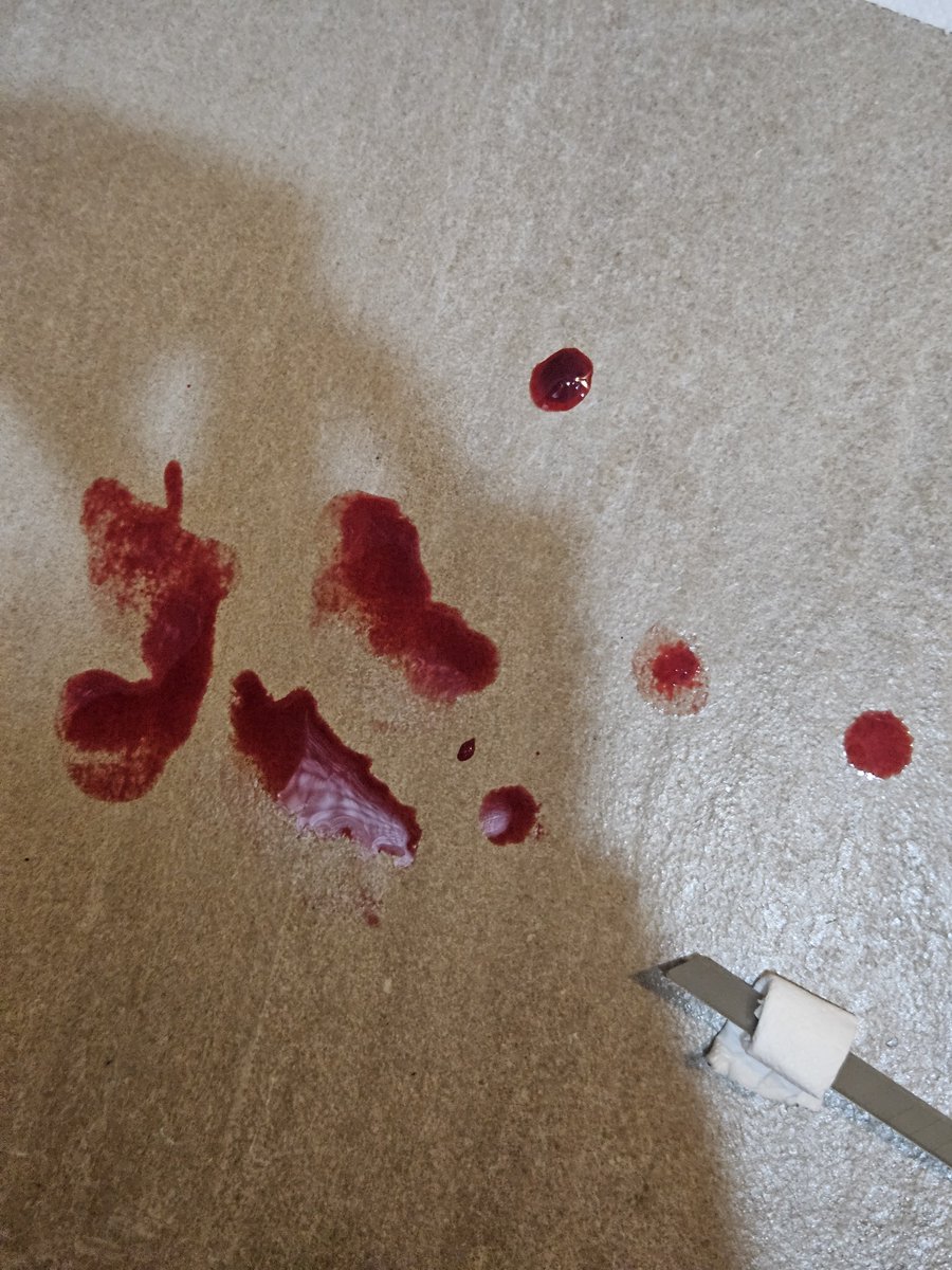 c37hv's tweet photo. #shtwt  #shtwtt  #shwtt  #sfxmakeup  #sfx 

! FAKE BLOOD ! https://t.co/v4tWmfqHe0